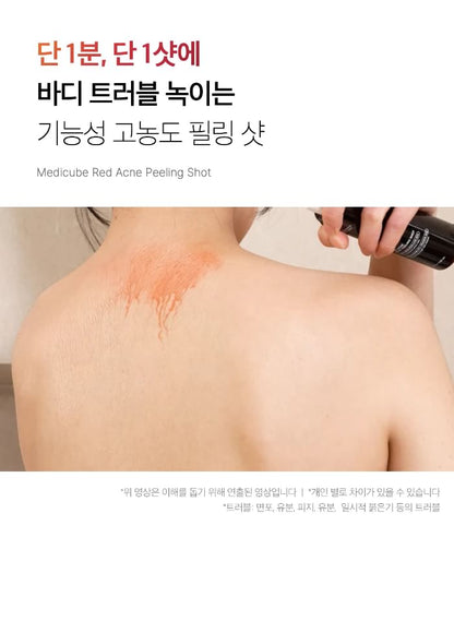 medicube - Red Acne Body Peeling Shot