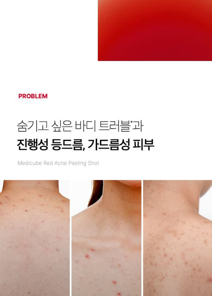 medicube - Red Acne Body Peeling Shot